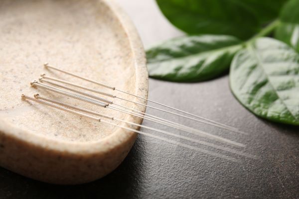 Chinese acupuncture needles